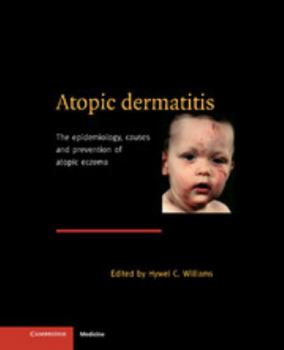 Hardcover Atopic Dermatitis Book