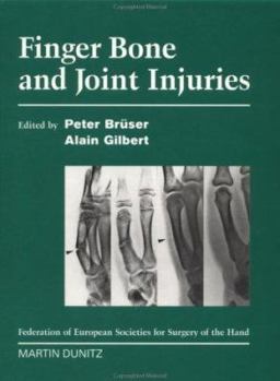 Hardcover Finger Bone and Joint Injuries Book
