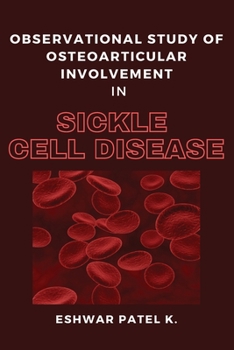 Paperback Observational Study of Osteoarticular Involvement in Sickle Cell Disease Book