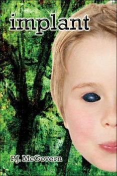 Paperback Implant Book