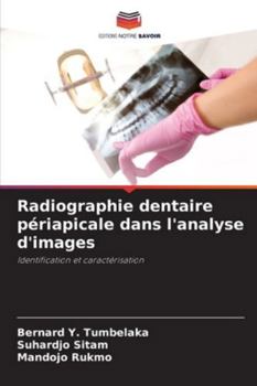 Paperback Radiographie dentaire périapicale dans l'analyse d'images [French] Book