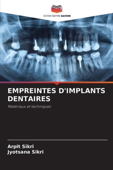 Paperback Empreintes d'Implants Dentaires [French] Book