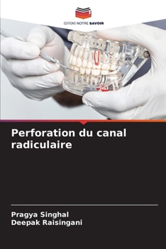 Paperback Perforation du canal radiculaire [French] Book