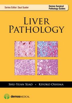 Paperback Liver Pathology Book