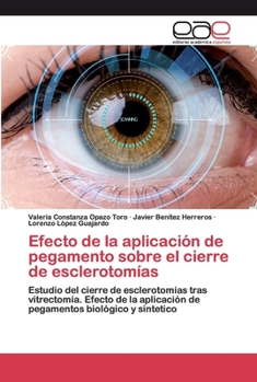 Paperback Efecto de la aplicación de pegamento sobre el cierre de esclerotomías [Spanish] Book