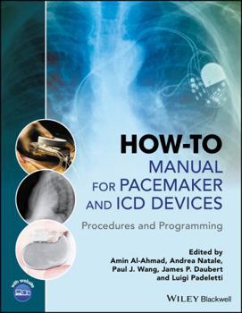 How-To Manual for Pacemaker and ICD Devices: Procedures and Programming