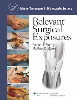 Hardcover Master Techniques in Orthopaedic Surgery: Relevant Surgical Exposures Book