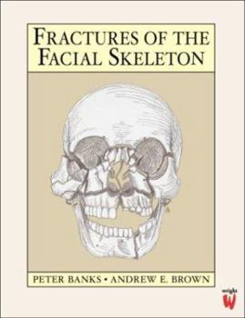 Paperback Fractures of the Facial Skeleton Book