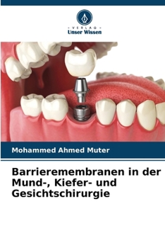 Paperback Barrieremembranen in der Mund-, Kiefer- und Gesichtschirurgie [German] Book