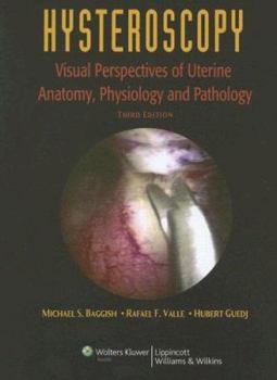 Hardcover Hysteroscopy: Visual Perspectives of Uterine Anatomy, Physiology, and Pathology Book