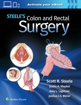 Hardcover Steele's Colon and Rectal Surgery Book