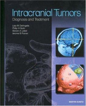 Hardcover Intracranial Tumors: Diagnosis and Treatment Book