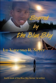 Paperback Scarred by the Blue Sky Book