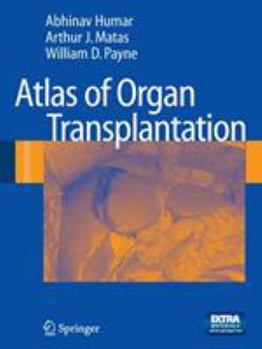 Paperback Atlas of Organ Transplantation [With DVD] Book