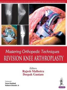 Hardcover Mastering Orthopedic Techniques: Revision Knee Arthroplasty Book