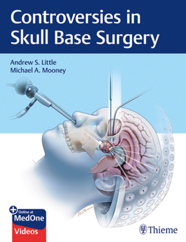 Hardcover Controversies in Skull Base Surgery Book