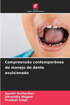 Compreensão contemporânea do manejo do dente avulsionado (Portuguese Edition)