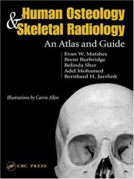 Hardcover Human Osteology and Skeletal Radiology: An Atlas and Guide Book