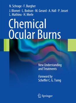 Hardcover Chemical Ocular Burns: New Understanding and Treatments Book