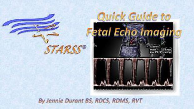 Spiral-bound STARSS Quick Guide to Fetal Echo Imaging Book