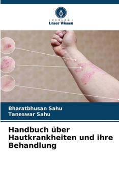 Paperback Handbuch über Hautkrankheiten und ihre Behandlung [German] Book