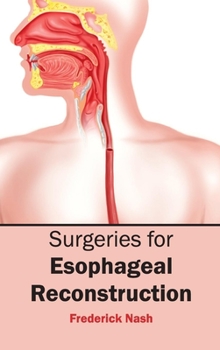 Hardcover Surgeries for Esophageal Reconstruction Book