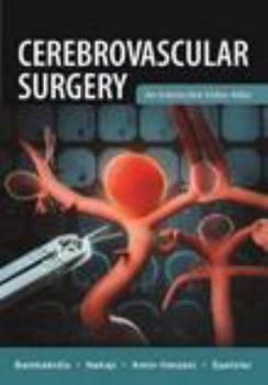 Hardcover Cerebrovascular Surgery Book