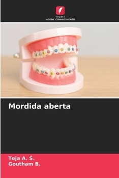Mordida aberta (Portuguese Edition)