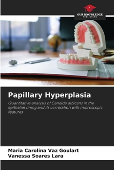 Paperback Papillary Hyperplasia Book