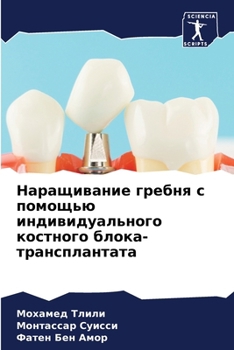 Paperback Наращивание гребня с пом [Russian] Book