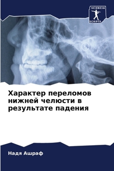 Paperback Характер переломов нижн& [Russian] Book
