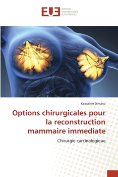 Paperback Options chirurgicales pour la reconstruction mammaire immediate [French] Book