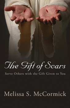 Paperback The Gift of Scars: Serve Others with the Gift Given to You Book