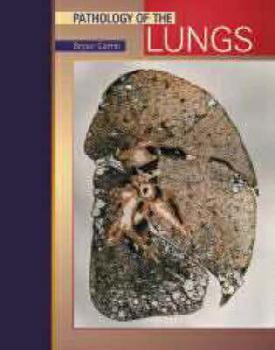 Hardcover Pathology of Lung Tumors Book