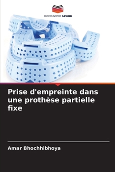 Paperback Prise d'empreinte dans une prothèse partielle fixe [French] Book