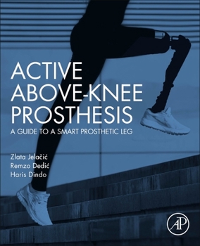 Paperback Active Above-Knee Prosthesis: A Guide to a Smart Prosthetic Leg Book