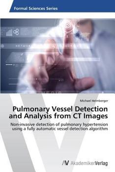 Paperback Pulmonary Vessel Detection and Analysis from CT Images Book