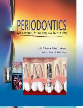 Hardcover Periodontics: Medicine, Surgery and Implants Book