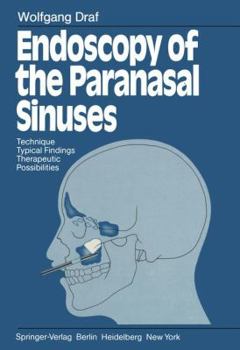 Paperback Endoscopy of the Paranasal Sinuses: Technique - Typical Findings Therapeutic Possibilities Book