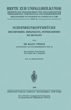 Paperback Schienbeinkopfbrüche: Bruchformen, Behandlung, Spätergebnisse Bei 486 Fällen [German] Book