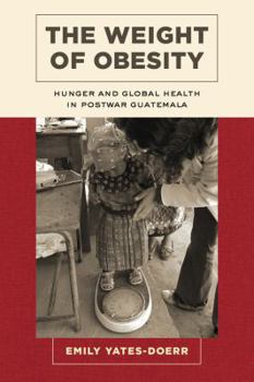 Paperback The Weight of Obesity: Hunger and Global Health in Postwar Guatemala Volume 57 Book