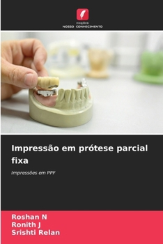 Paperback Impressão em prótese parcial fixa [Portuguese] Book