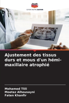 Paperback Ajustement des tissus durs et mous d'un hémi-maxillaire atrophié [French] Book
