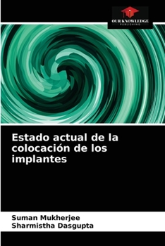 Paperback Estado actual de la colocación de los implantes [Spanish] Book