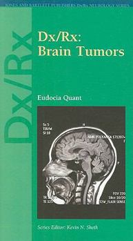 Paperback DX/RX: Brain Tumors Book