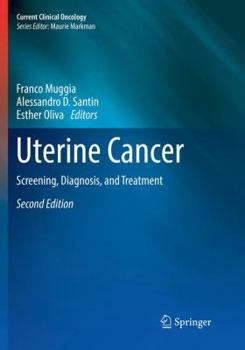 Paperback Uterine Cancer: Screening, Diagnosis, and Treatment Book