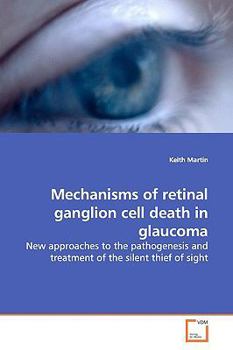 Paperback Mechanisms of retinal ganglion cell death in glaucoma Book