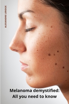 Paperback Melanoma demystified All you need to know Book