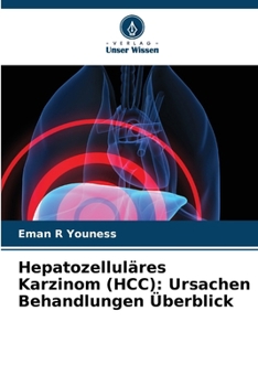 Hepatozelluläres Karzinom (HCC): Ursachen Behandlungen Überblick (German Edition)