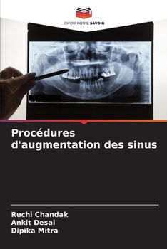 Paperback Procédures d'augmentation des sinus [French] Book